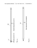 Guide-Wire Dilation Device for Facilitation of Lesion Crossing diagram and image