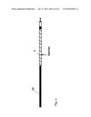 Guide-Wire Dilation Device for Facilitation of Lesion Crossing diagram and image