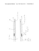 Guide-Wire Dilation Device for Facilitation of Lesion Crossing diagram and image