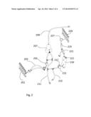 AUTOMATED INSTALLATION PROCEDURE FOR A DISPOSABLE FLOW PATH diagram and image