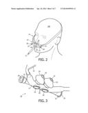 SYSTEM AND METHOD FOR LIMITED FLOW RESPIRATORY THERAPY diagram and image