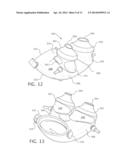 CUSHION FOR A PATIENT INTERFACE diagram and image