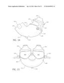 CUSHION FOR A PATIENT INTERFACE diagram and image