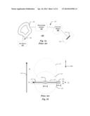 APPARATUS FOR TREATING ION BEAM diagram and image