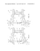 FRONT SUBFRAME FOR A NARROW OFFSET COLLISION diagram and image