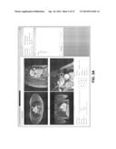 Comprehensive Cardiovascular Analysis with Volumetric Phase-Contrast MRI diagram and image