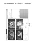 Comprehensive Cardiovascular Analysis with Volumetric Phase-Contrast MRI diagram and image