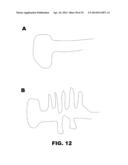 NUCLEIC ACID PROBES AND METHODS OF USING THE SAME diagram and image