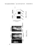 MELANOCORTIN 1 RECEPTOR LIGANDS AND METHODS OF USE diagram and image