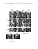 MELANOCORTIN 1 RECEPTOR LIGANDS AND METHODS OF USE diagram and image