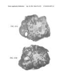 MELANOCORTIN 1 RECEPTOR LIGANDS AND METHODS OF USE diagram and image