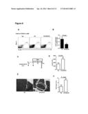 Methods to treat pancreatic inflammation and associated lung injury     through regulation of pancreatic interleukin-22 expression diagram and image