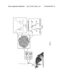 Analegisic (Sebacoyl dinalbuphine ester) PLGA controlled release     formulation form diagram and image