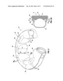 HYDRAULIC-MECHANICAL GASTRIC BAND diagram and image