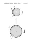 HYDRAULIC-MECHANICAL GASTRIC BAND diagram and image