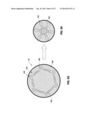 HYDRAULIC-MECHANICAL GASTRIC BAND diagram and image