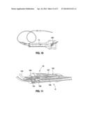 HYDRAULIC-MECHANICAL GASTRIC BAND diagram and image