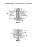 HYDRAULIC-MECHANICAL GASTRIC BAND diagram and image