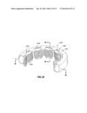 HYDRAULIC-MECHANICAL GASTRIC BAND diagram and image