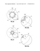 HYDRAULIC-MECHANICAL GASTRIC BAND diagram and image