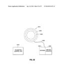 HYDRAULIC-MECHANICAL GASTRIC BAND diagram and image