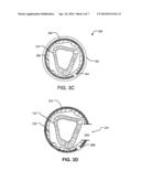 UNIVERSAL ENDOSCOPE ATTACHMENT SYSTEM AND RELATED METHODS OF USE diagram and image