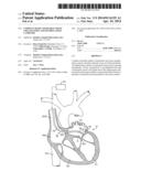 Complex Shape Steerable Tissue Visualization and Manipulation Catheter diagram and image