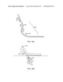 Complex Shape Steerable Tissue Visualization and Manipulation Catheter diagram and image