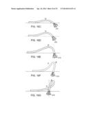 Complex Shape Steerable Tissue Visualization and Manipulation Catheter diagram and image