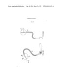 Complex Shape Steerable Tissue Visualization and Manipulation Catheter diagram and image