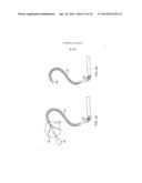 Complex Shape Steerable Tissue Visualization and Manipulation Catheter diagram and image