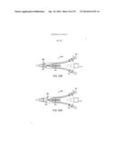 Complex Shape Steerable Tissue Visualization and Manipulation Catheter diagram and image