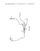 Complex Shape Steerable Tissue Visualization and Manipulation Catheter diagram and image