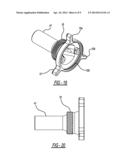 Tissue Retractor diagram and image