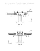 Retractor diagram and image