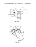 Retractor diagram and image