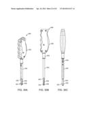 Retractor diagram and image