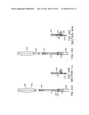 Retractor diagram and image