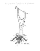 Retractor diagram and image