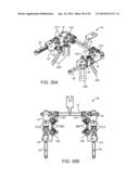 Retractor diagram and image