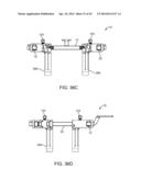 Retractor diagram and image