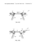 Retractor diagram and image