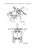 Retractor diagram and image