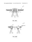 Retractor diagram and image