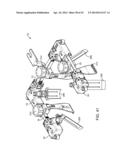 Retractor diagram and image