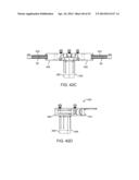 Retractor diagram and image