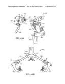 Retractor diagram and image