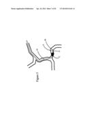 SYSTEMS AND METHODS FOR ASSESSING VASCULATURE HEALTH AND BLOOD CLOTS diagram and image