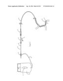 SYSTEMS AND METHODS FOR ASSESSING VASCULATURE HEALTH AND BLOOD CLOTS diagram and image