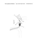 SYSTEMS AND METHODS FOR ASSESSING VASCULATURE HEALTH AND BLOOD CLOTS diagram and image